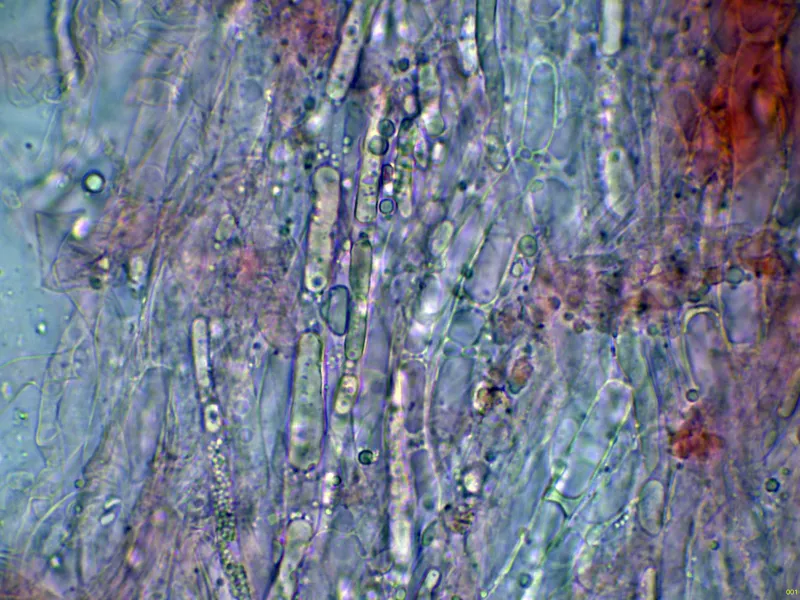Artomyces pyxidatus 10 - Hifas oleíferas-001